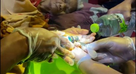 Petugas Damkar Pekanbaru membantu lepaskan cincin di jari nenek 82 tahun. F. :. CAKAPLAH.COM