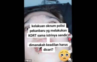 Korban penganiayaan oleh oknum Polresta Pekanbaru. F : IST