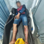 Bandar Narkoba Ditembak Usai Tikam Polisi di Tenayan Raya Pekanbaru