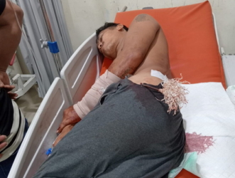 Konflik Lahan Pecah di Sentajo Raya Kuansing, 9 Warga Luka-luka