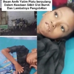 Viral! Kisah Pilu di Dumai; Bocah Yatim Piatu Korban Gizi Buruk Tewas